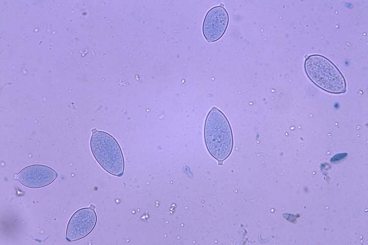 Kraut- und Braunfäule (Phytophthora infestans): Sporangien