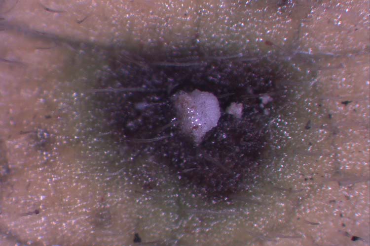 Blattfallkrankheit (Drepanopeziza ribis) Acervuli