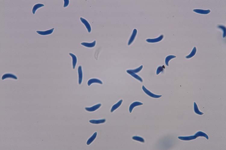 Blattfallkrankheit (Drepanopeziza ribis) Konidien