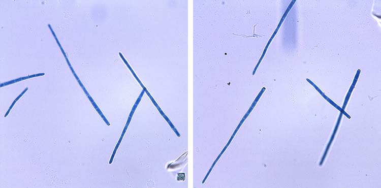 Staengelschwaerze (Cercospora zebrina) an Rotklee: Konidien