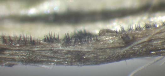 Südlicher Stängelbrenner oder Anthracnose (Colletotrichum trifolii): Setae 