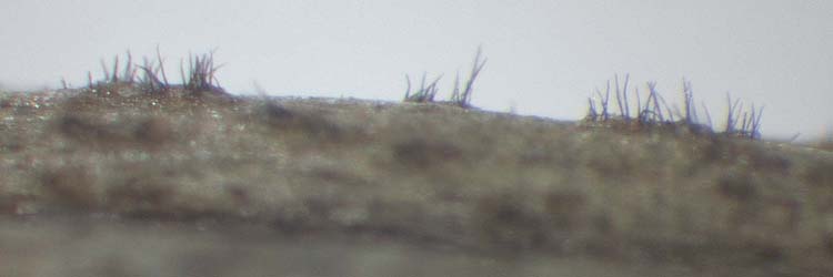 Staenglbrenner (Colletotrichum trifolii) an Rotklee: Setae