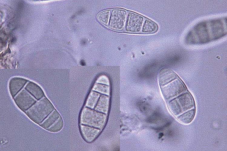 Ascosporen der Leptosphaerulina trifolii