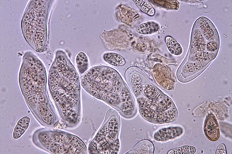 Asci mit Ascosporen der Leptosphaerulina trifolii an Luzerne