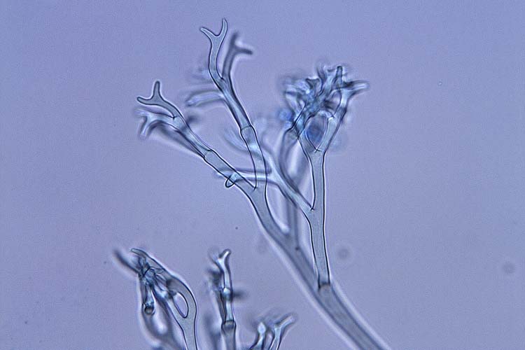 Falscher Mehltau (Peronospora trifoliorum): Sporangienträger