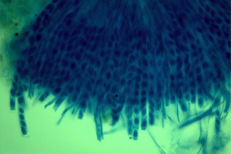 Kleekrebs (Sclerotinia trifoliorum): Asci mit Ascosporen