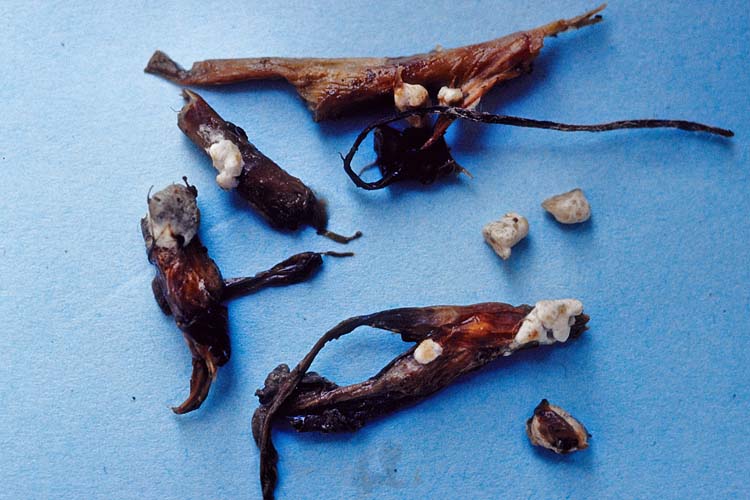 Kleekrebs (Sclerotinia trifoliorum) an Rotklee: Sklerotien