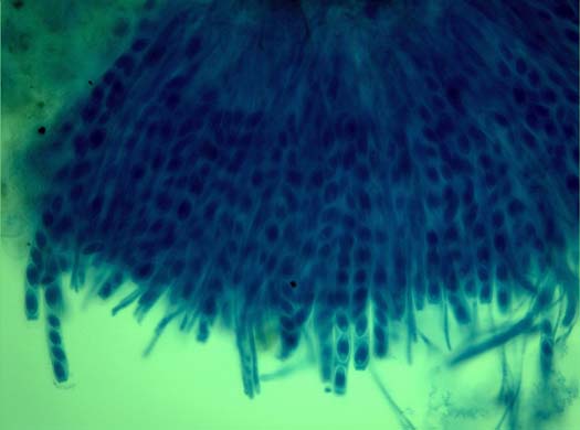 Kleekrebs (Sclerotinia trifoliorum): Asci, Ascosporen