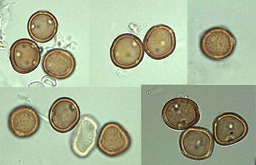 Kleerost (Uromyces trifolii-repentis var. fallans): Uredosporen