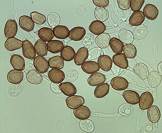 Kleerost (Uromyces trifolii): Teleutosporen