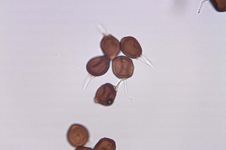 Bohnenrost (Uromyces appendiculatus) Teleutsporen