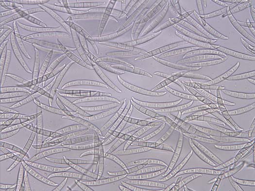 Makrokonidien (Fusarium graminearum)