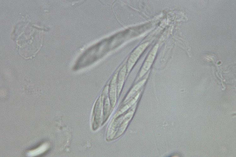 Asci mit Ascosporen der Gibberella zeae