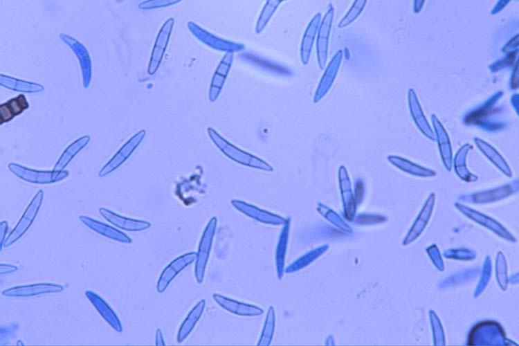 Gibberella zeae (Ascosporen) 
