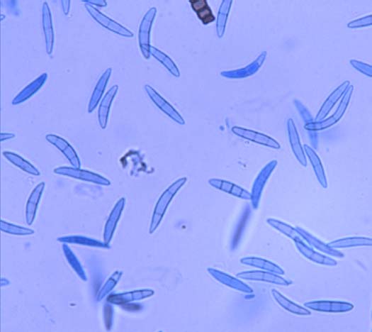 Gibberella zeae: Ascosporen