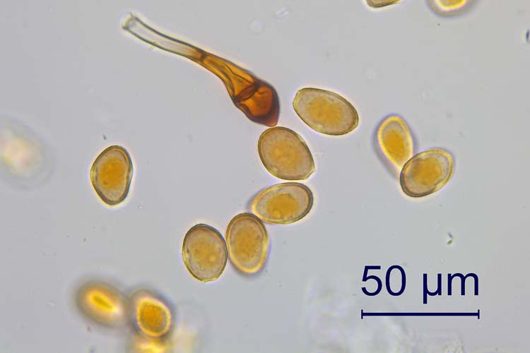 Schwarzrost (Puccinia graminis) an Roggen: Urdeosporen