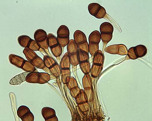 Maisrost (Puccinia sorghi): Teleutosporen