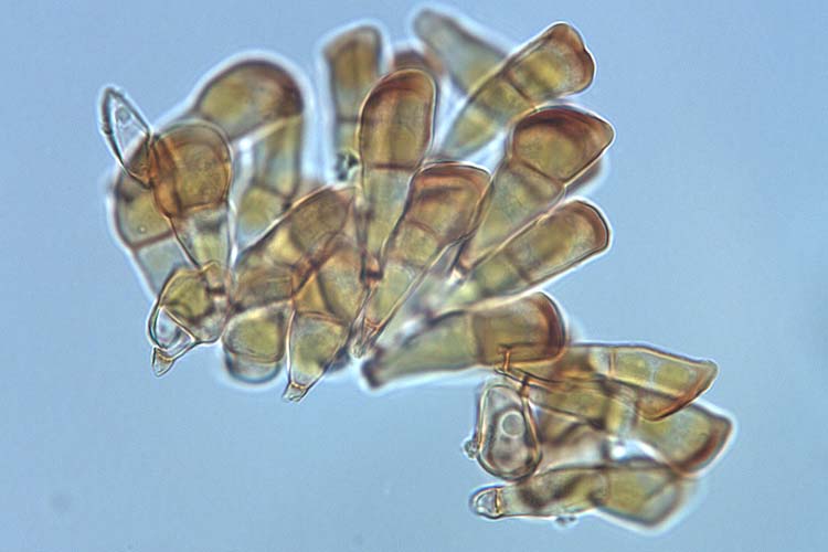 Gelbrost (Puccinia striiformis) Teleutosporen