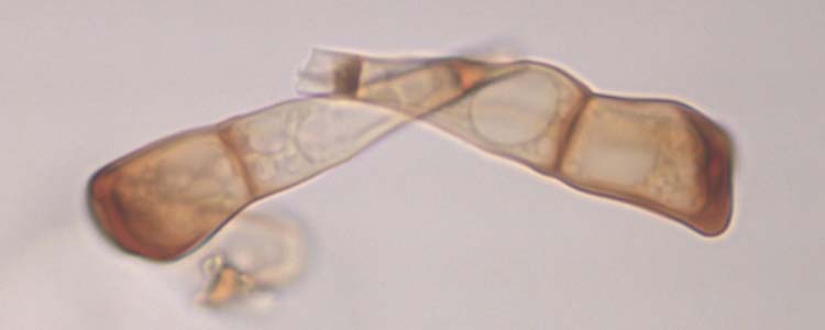 Weizenbraunrost (Puccinia triticina) Teleutosporen