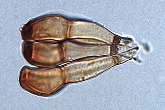 Weizenbraunrost (Puccinia triticina): Teleutosporen