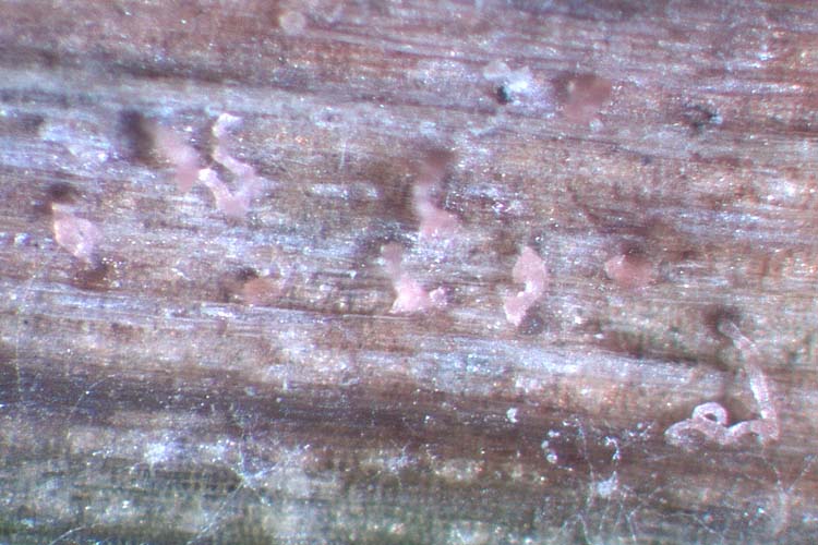 Blatt- und Spelzenbräune (Septoria nodorum) Weizen Pyknidien
