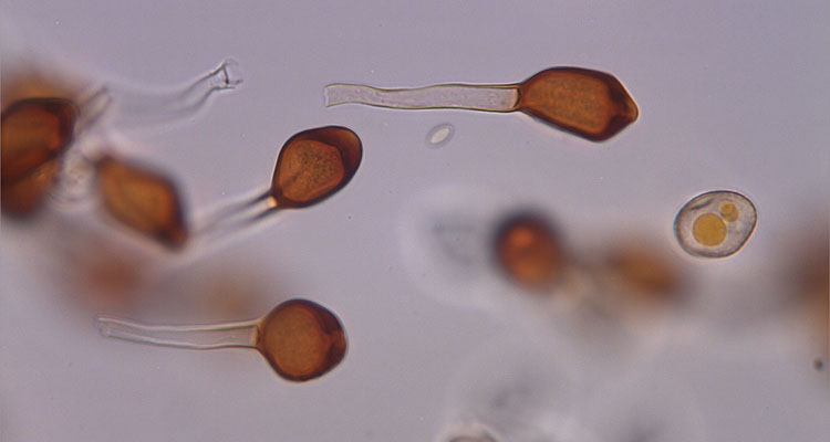 Ackerbohnenrost (Uromyces viciae fabae) Teleutosporen