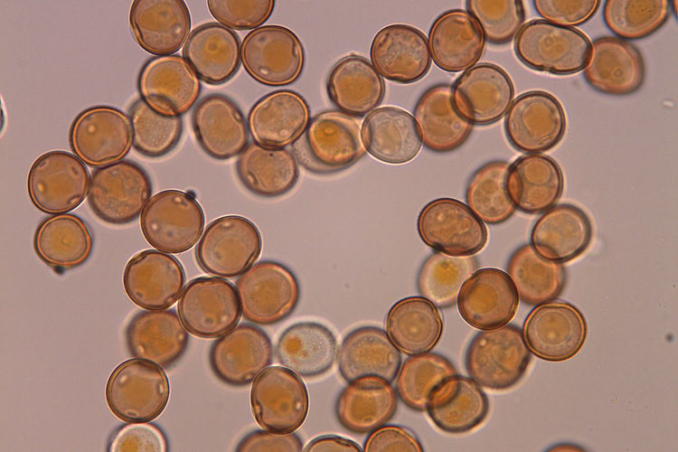 Ackerbohnenrost (Uromyces viciae fabae) Uredosporen
