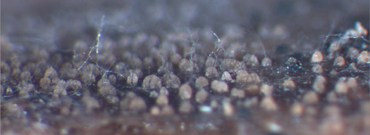 Colletotrichum coccodes: Acervuli