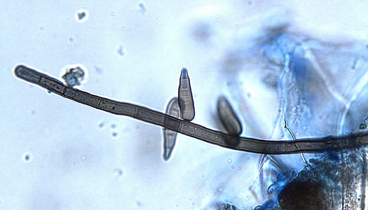 Konidien (Helminthosporium solani)