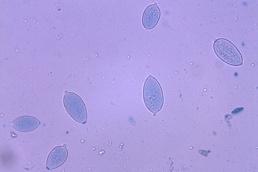 Sporangien von Phytophthora infestans