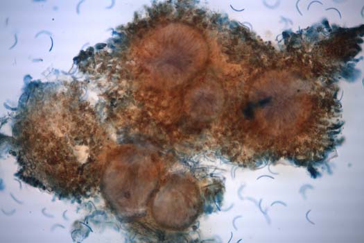 Pyknidien von Mycosphaerella pyri dem Erreger der Weissfleckenkrankheit der Birne