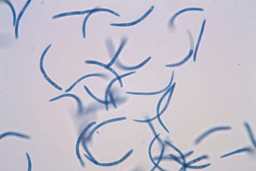 Konidien der Mycosphaerella pyri dem Erreger der Weissfleckenkrankheit der Birne