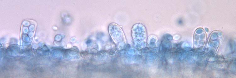 Asci der Taphrina deformans (Kräuselkrankheit des Pfirsichs)