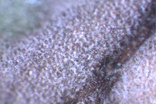 Sporenträger der Ramularia beticola