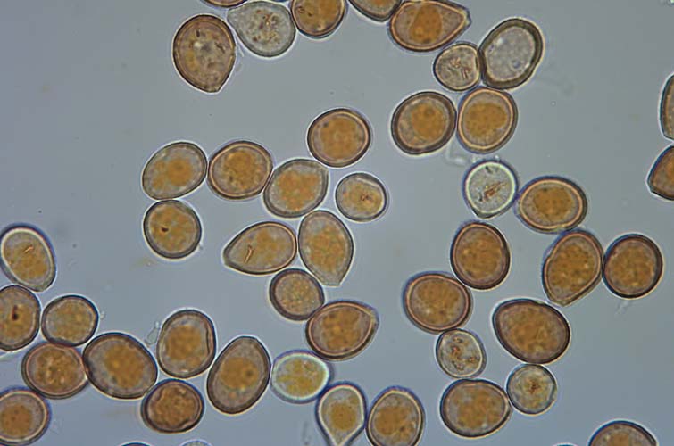 Rübenrost (Uromyces betae) Uredosporen