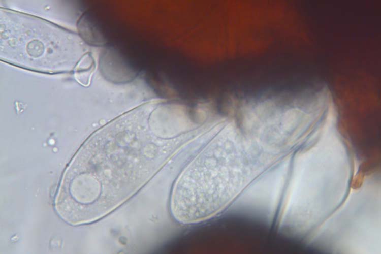 Echter Mehltau der Gräser (Blumeria graminis) Asci mit Ascosporen