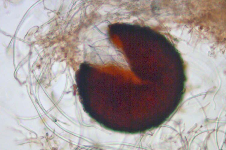Echter Mehltau des Getreides (Blumeria graminis), Kleistothecium mit Asci
