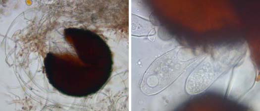 echter Mehltau der Gräser (Blumeria graminis): Kleistothecium