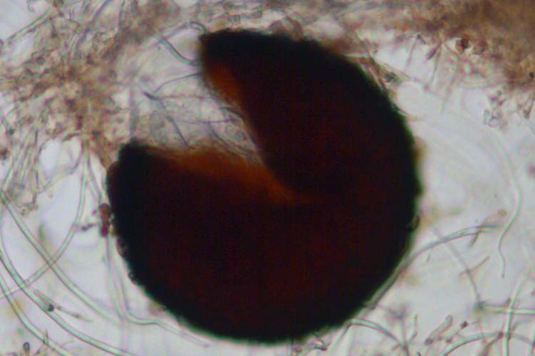 Echter Mehltau der Gräser (Blumeria graminis) Kleistothecium
