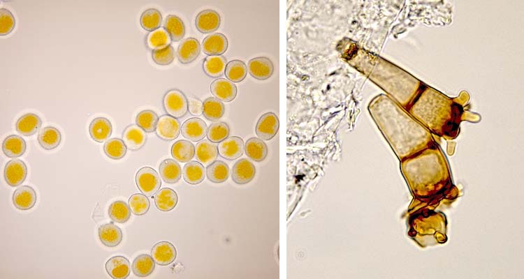 Kronenrost (Puccinia coronata) Uredosporen und Teleutosporen