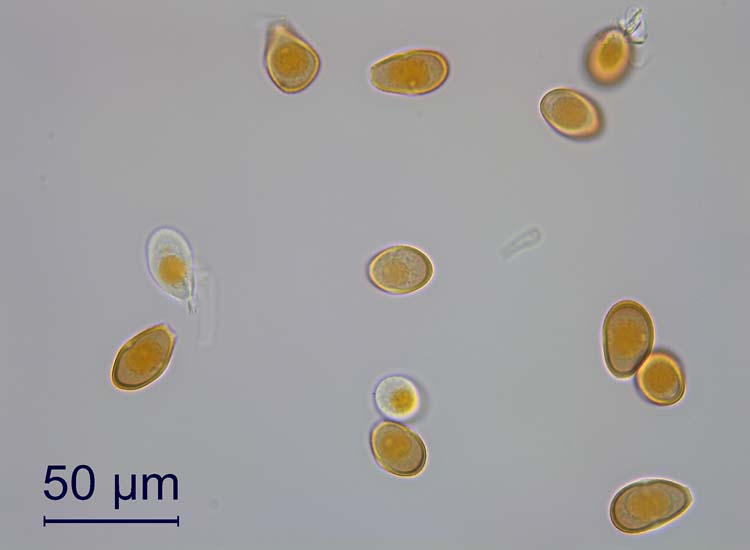 Schwarzrost (Puccinia graminis) Uredosporen