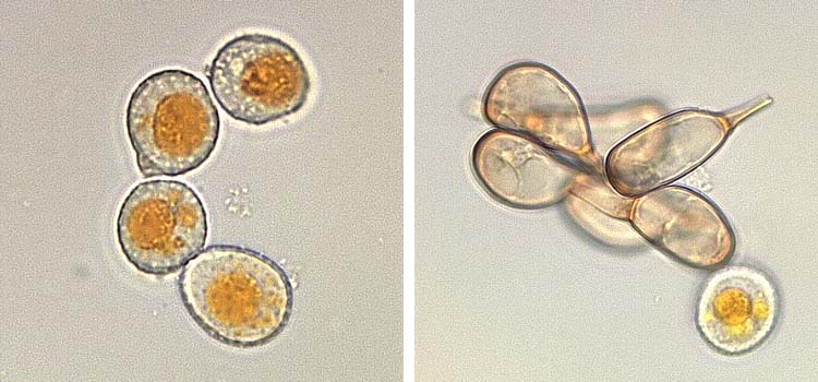 Uromyces dactylidis:  Uredo- und Teleutosporen