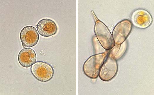 Uromyces dactylidis var. poae:  Uredo- und Teleutosporen