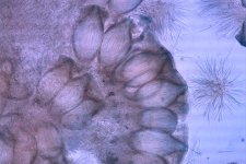 Mutterkorn (Claviceps purpurea)