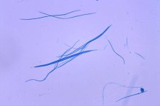 Mutterkorn (Claviceps purpurea)