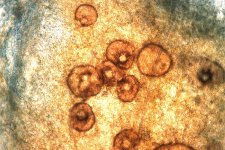 Septoria-Blattfleckenkrankheit (Septoria apiicola): flaschenförmige Pyknidien.